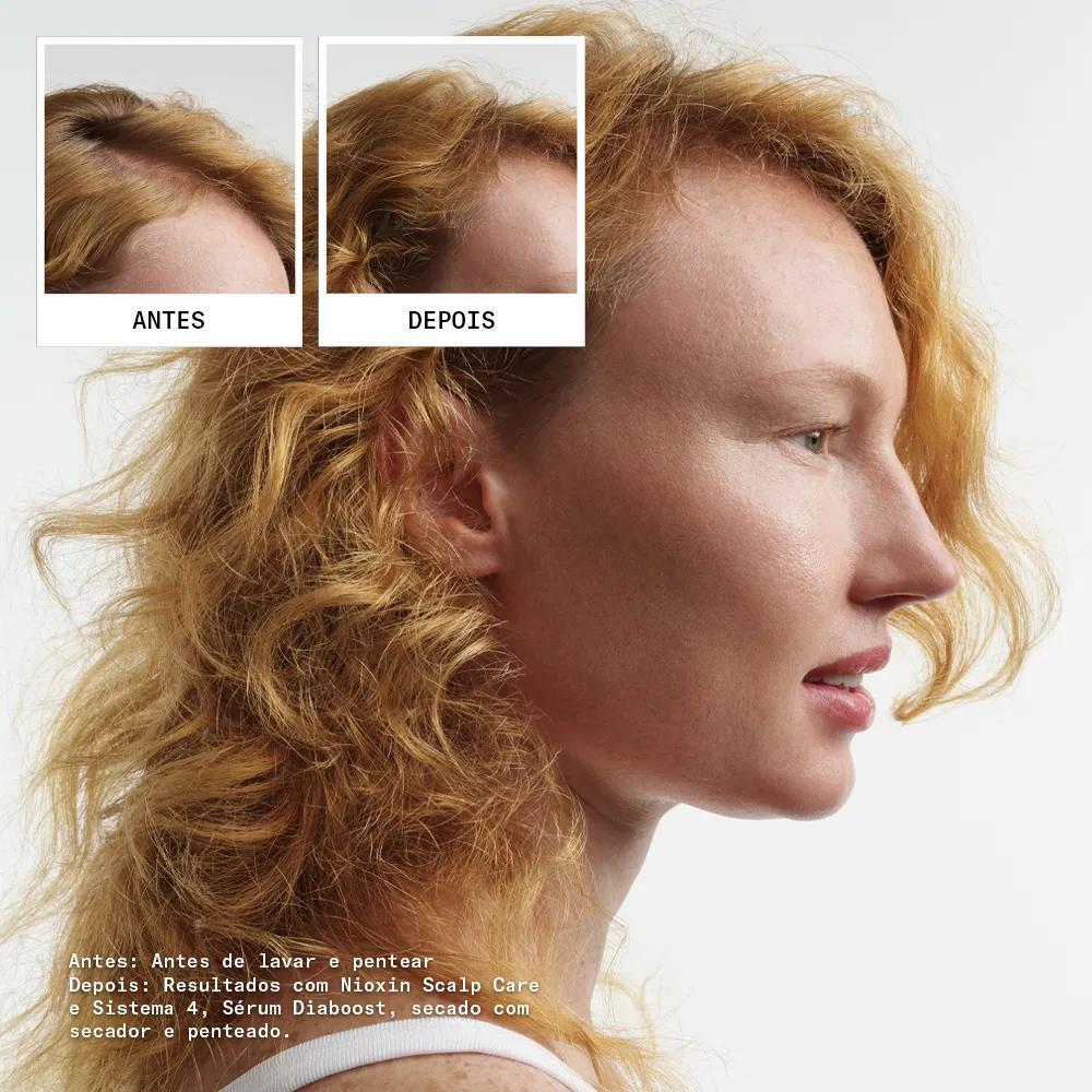 Antes e depois em cabelos ruivos usando o Kit Sistema 4 de Nioxin