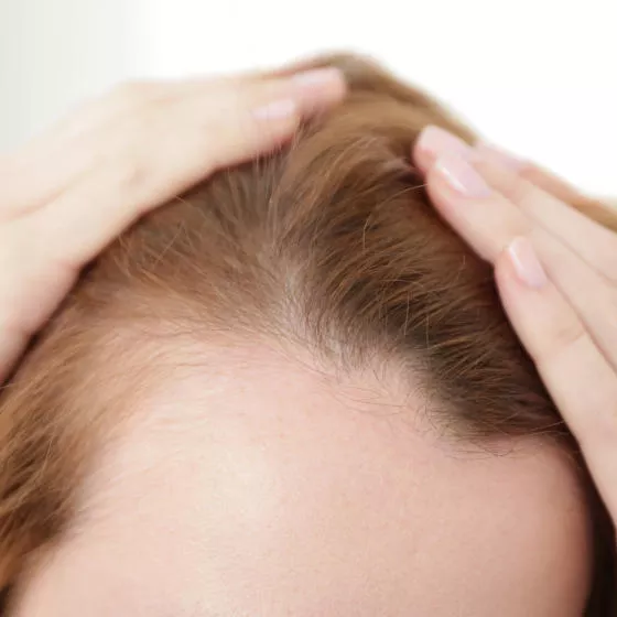 Haar 20 lichtes mit Dünnes Haar: