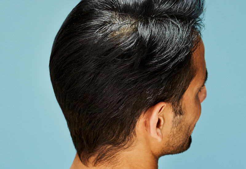 How to Style A Man's Thinning Crown | Nioxin