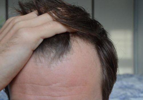 Scalp Care & Thin Hair: Cleanse, Nourish, Protect | NIOXIN Scalp Care & Thin Hair: Cleanse, Nourish, Protect | NIOXIN