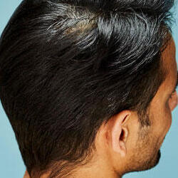8 Hair Cuts & Hairstyles For A Receding Hairline | NIOXIN