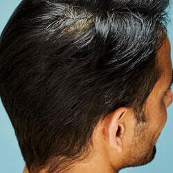 8 Hair Cuts & Hairstyles For A Receding Hairline | NIOXIN 8 Hair Cuts & Hairstyles For A Receding Hairline | NIOXIN